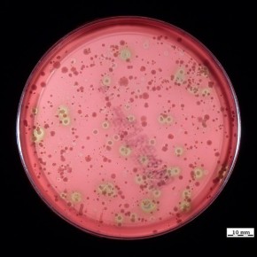 bacterie